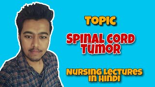 Testicular tumorCancer treatment in hindi [upl. by Idid783]