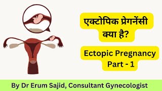 Ectopic Pregnancy Causes Signs Symptoms amp Treatment  Dr Erum Hassan Clinic Best Gynaecologist [upl. by Annayrb]