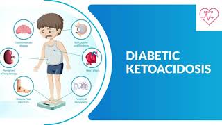 Diabetic Ketoacidosis  Endocrinology lectures  Medicine Neet pg  FMGE  Mrcp [upl. by Yensehc678]