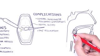 When Should You Remove Your Tonsils  The Doctors [upl. by Allare822]