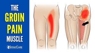 The Groin Pain Muscle How to Release It for INSTANT RELIEF [upl. by Marcello]