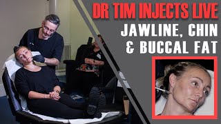 FULL JAWLINE TREATMENT Dr Tim Injects Jawline Chin amp Buccal Fat Live Aesthetics Mastery Show [upl. by Sirrah]