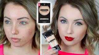 Foundation Friday WET N WILD COVERALL FOUNDATION amp POWDER First Impression Review  AcnePale Skin [upl. by Eylk886]