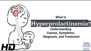 Hyperprolactinemia Unraveled The Root Causes Revealed [upl. by Ttenna124]