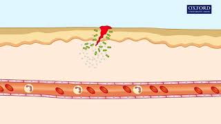 Animation 241 Inflammatory response [upl. by Gamal]