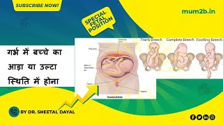 Fetal Positions for Birth  Abnormal Positions in womb  Mum2b [upl. by Negem]