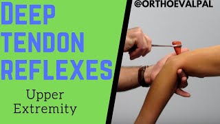 Deep Tendon Reflexes of the Upper Extremities [upl. by Kirtap455]