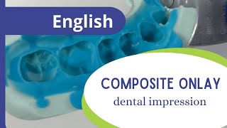 Composite onlay  part 2 dental impression [upl. by Nnaesor]