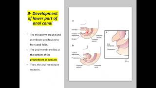 Revision hindgut Digestive 45 [upl. by Niliac]