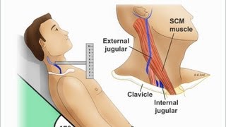 Jugular Venous Distention Explained clearly PART A Jugular venous pressure Waveform [upl. by Fellner]