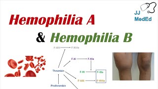 A History of Hemophilia Treatment Factor Replacement to Gene Therapy [upl. by Garvy]