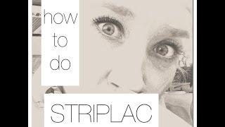 how to do STRIPLAC [upl. by Keslie712]