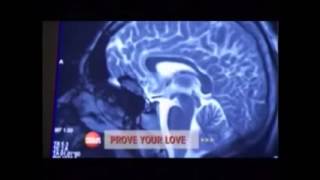 Cerebro enamorado  Documental de Discovery Sciencie [upl. by Mountfort]