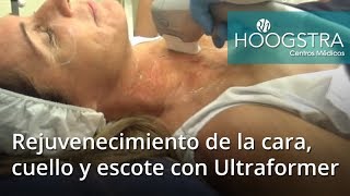 Rejuvenecimiento de la cara cuello y Escote con ultraformer 18050 [upl. by Anos401]