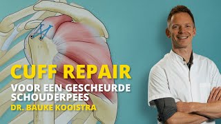 Cuff repair operatie voor gescheurde schouderpees [upl. by Eimas267]