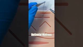 The Horizontal Mattress Suture suturing sutures horizontalmattress stitch wound urgentcare [upl. by Ailad]