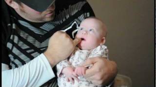 Oral Exercises for Babies with Down Syndrome [upl. by Pappano]