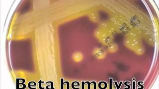 Comparison of hemolysis on blood agarmov [upl. by Petuu694]