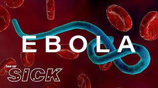 What Ebola Does to the Body [upl. by Ahsinar]