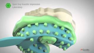 How to take open close tray impression  AlphaBio Tec [upl. by Jeffcott]