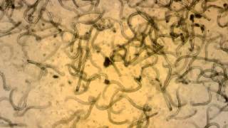 Aelurostrongylus abstrusus L1 Larvae after Baermann Method Examination  Domestic Cat  2014 [upl. by Sax842]