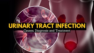 Urinary Tract Infection Causes Signs and Symptoms Diagnosis and Treatment [upl. by Reeba]