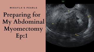 Preparing for my Abdominal Myomectomy Surgery  Fibroid Removal TTC Ep 1 [upl. by Gilberta]