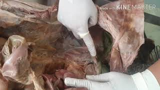 Dissection of Peritoneal Cavity by DrMeetu Agarwal [upl. by Beore]