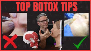 Top 6 Botox Injection Tips [upl. by Lemay]