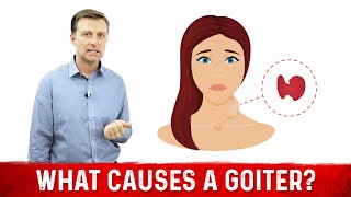 What Causes a Goiter Causes of Thyroid Enlargement – DrBerg [upl. by Rehpoitsirhc]