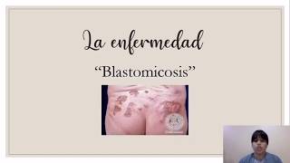 Blastomyces Dermatitidis Blastomicosis [upl. by Hannahsohs]