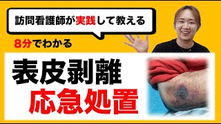 【表皮剥離】訪問看護師が教える緊急時対応方法！実践！ [upl. by Naujud]