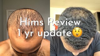 hims finasteride HIMS Review 1 FULL YEAR Update [upl. by Seward]