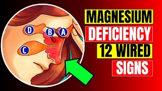 12 Strange Signs Your Body NEEDS Magnesium  HealthQuest [upl. by Mallina]