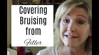 Covering Bruising from Filler OVER 50 [upl. by Salokcin89]