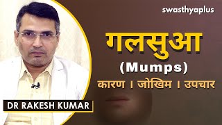 गलसुआ  क्या है कारण लक्षण और उपचार  Dr Rakesh Kumar on Mumps in Hindi  Causes amp Prevention [upl. by Junko403]