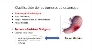 Cáncer Gástrico Generalidades Clínica y Diagnóstico [upl. by Ynottirb]