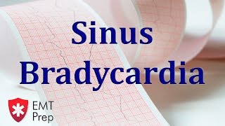 Sinus Bradycardia ECG  EMTprepcom [upl. by Corene]