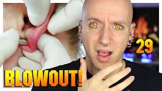 Reacting To Worst Ear Stretching Fail Ever  Piercings Gone Wrong 29  Roly Reacts [upl. by Ettenoitna]