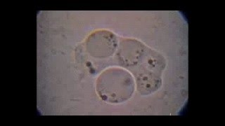 Trichomonas hominis con doble intento de fagocitosis de Blastocystis por un citostoma elástico [upl. by Paola97]