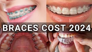 Braces Type amp Treatment Cost 2024  Metal vs Ceramic vs Lingual vs Invisalign Braces  Latest [upl. by Myles]