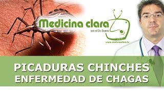 Picadura por chinches y enfermedad de Chagas  Como tratar las picaduras de chinches [upl. by Fatma501]