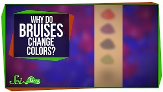 Why Do Bruises Change Colors [upl. by Bruni]