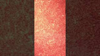 Microfilaria in a blood sample taken from a dog [upl. by Furey130]