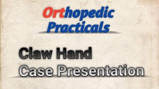 Claw Hand Case Presentation  MSDNB Orthopedic Practical Examination [upl. by Amari]