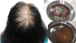 DIY Hibiscus Hair Mask for Extreme Hair Growth  Promote Hair Growth [upl. by Mccormac]