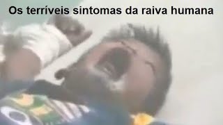 Os terríveis sintomas do vírus da raiva humana [upl. by Notirb]