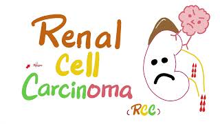 Renal Cell Carcinoma RCC  Kidney Tumors  Neoplasms  Renal Pathology  Nephrology [upl. by Terrill]