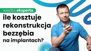 CENA PROTEZY ZĘBOWEJ NA IMPLANTACH i ALLON4 W 2024 POZNAJ RZECZYWISTE CENY [upl. by Nepean293]