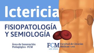 Ictericia  Fisiopatología y Semiología [upl. by Zirkle]